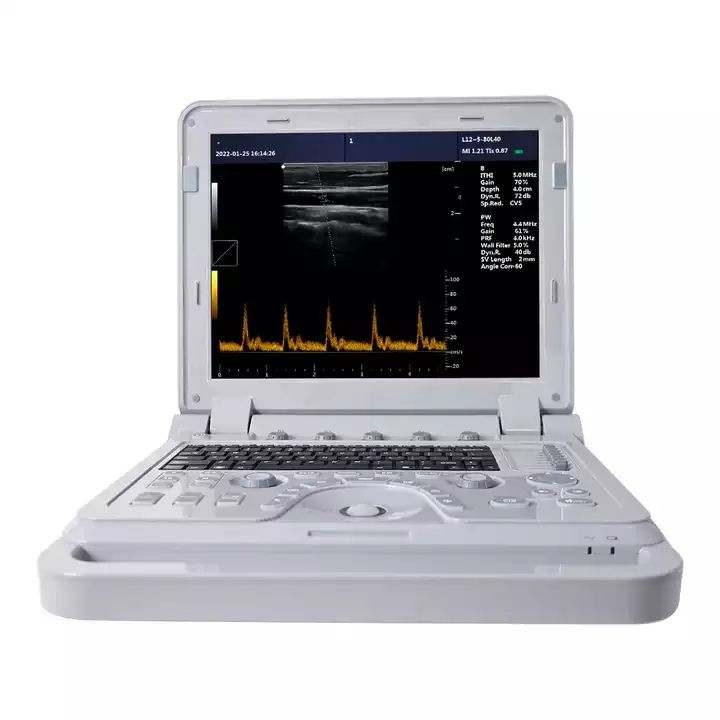 CMS600P2PLUS notebook ultrasound machine